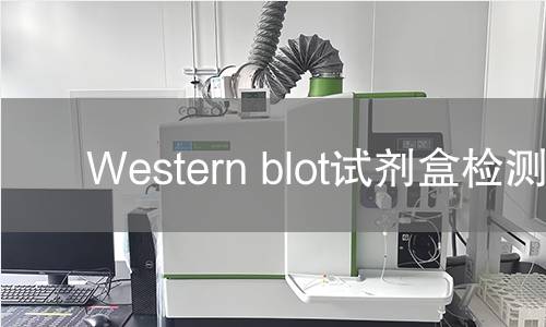 Western blot试剂盒检测 Western blot试剂盒检测